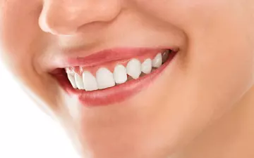 Clareamento Dental