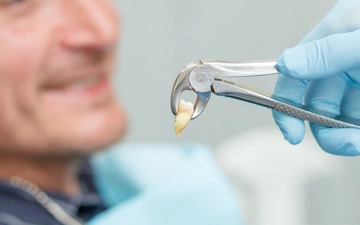 Extração De Dente