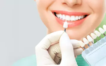 Facetas De Porcelana