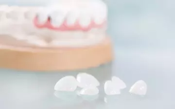 Facetas De Resina