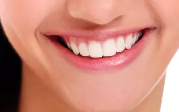 Gengivoplastia