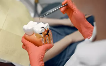 Restauração Dentária